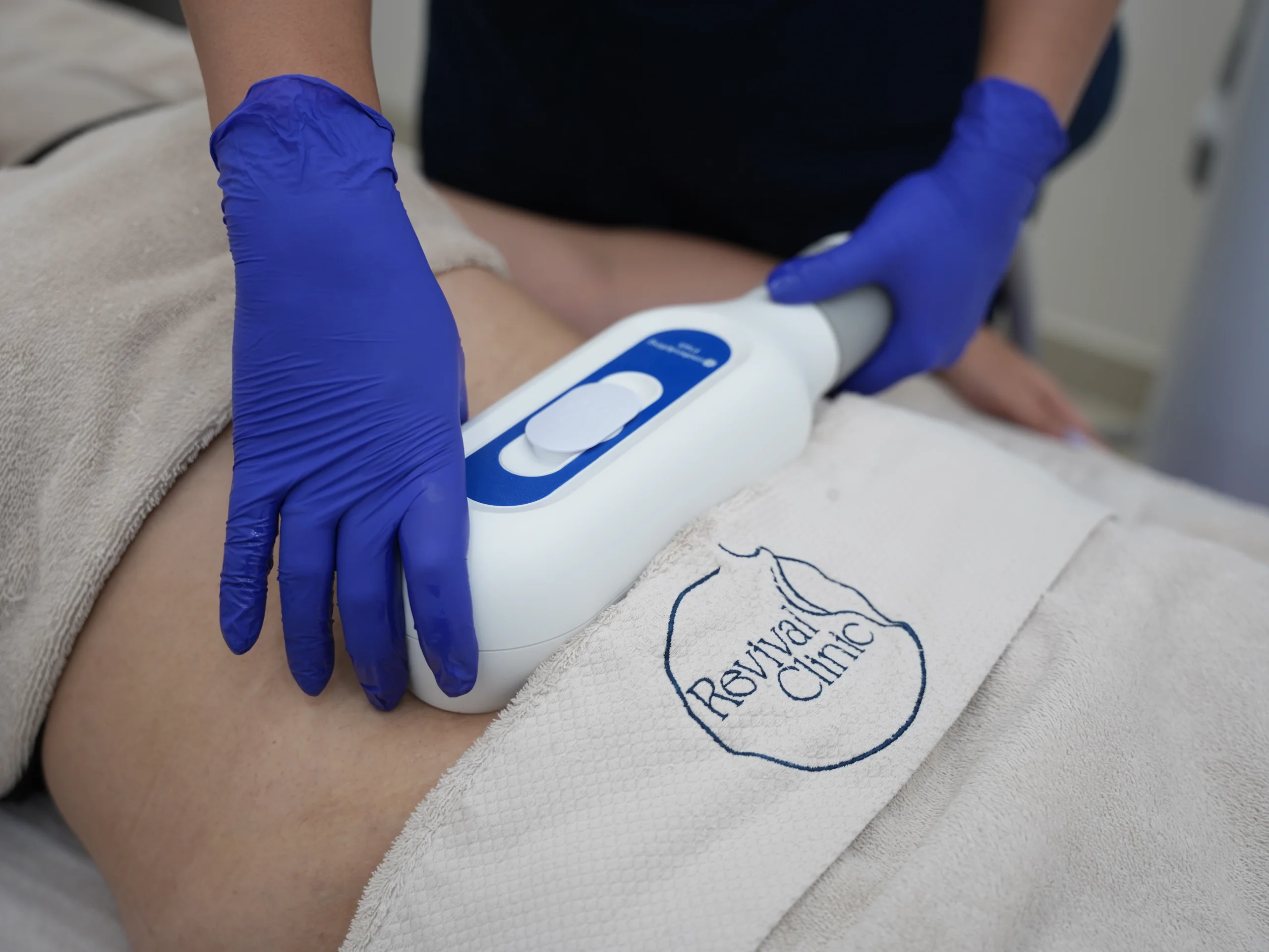 Coolsculpting vs Liposuction